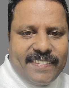GIRISH TD