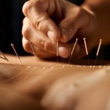 Cambridge Acupuncture Association