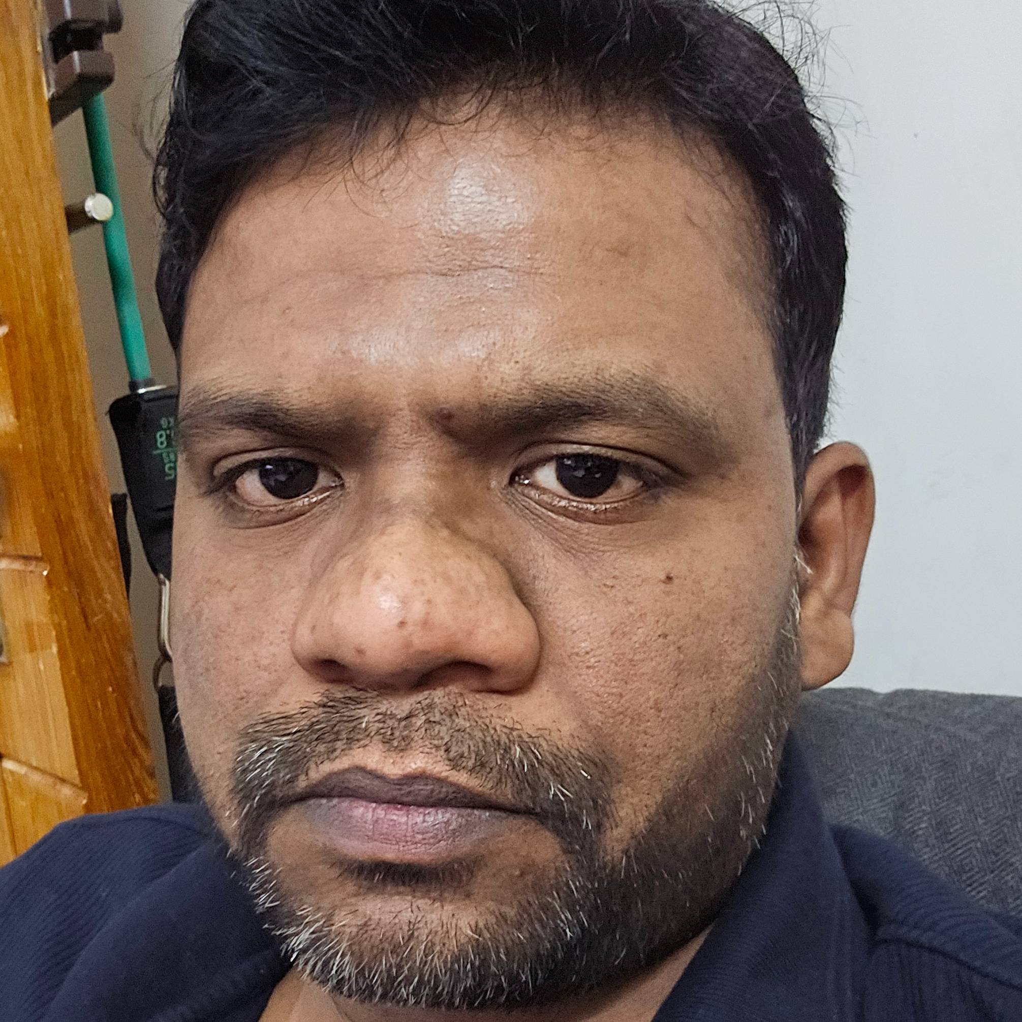Rohit Moses
